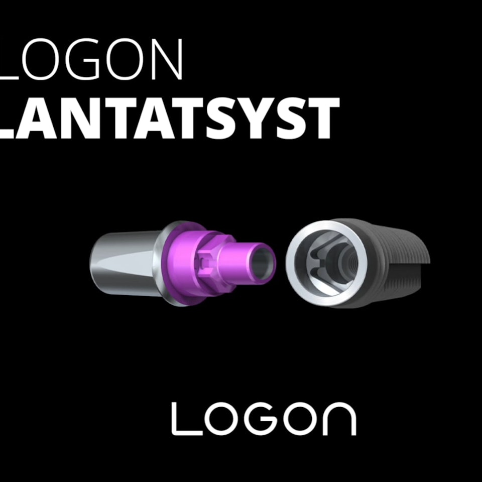 LOGON Implantatsystem Logon Implantatsystem
