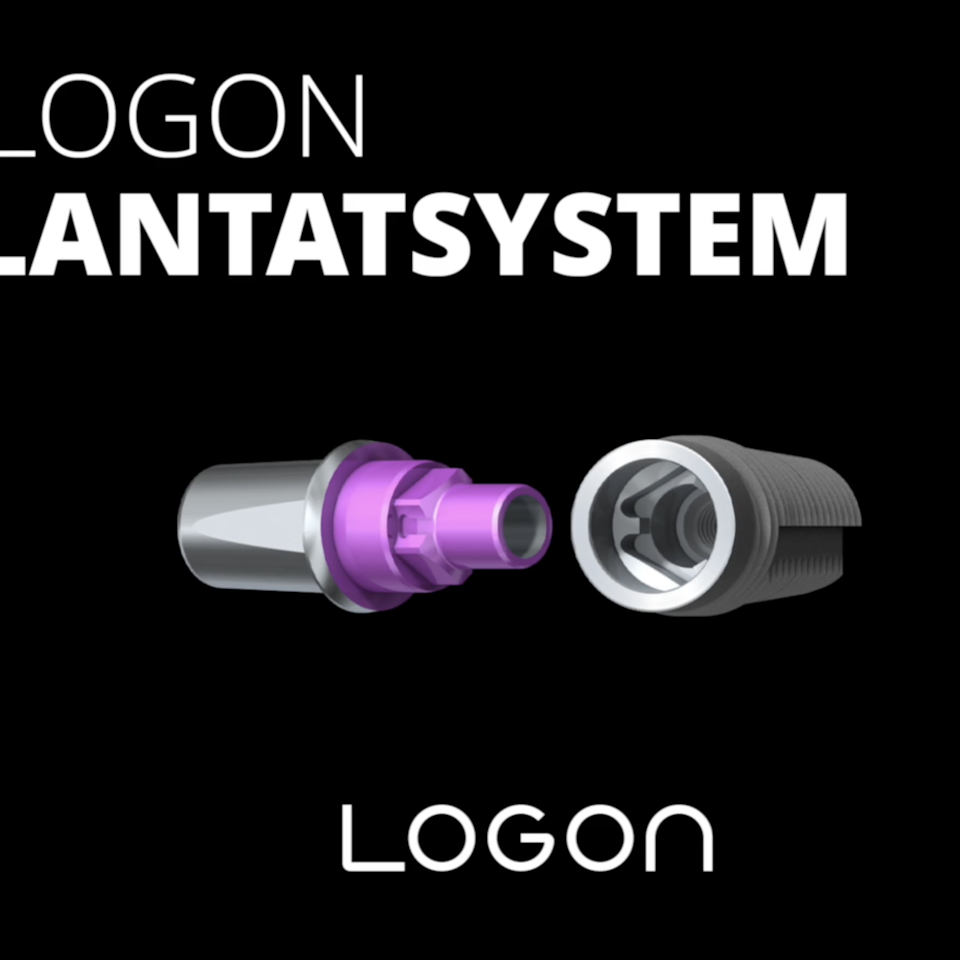 Querform Filmproduction - LOGON Implantatsystem
