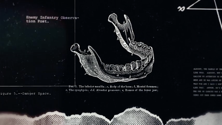 Where is Private Dulaney?