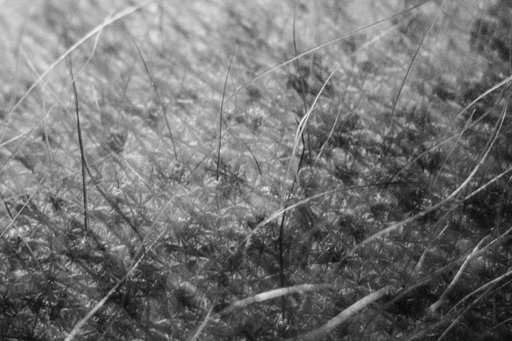 Macro super-closeup of freckles, skin and hair in black and white.