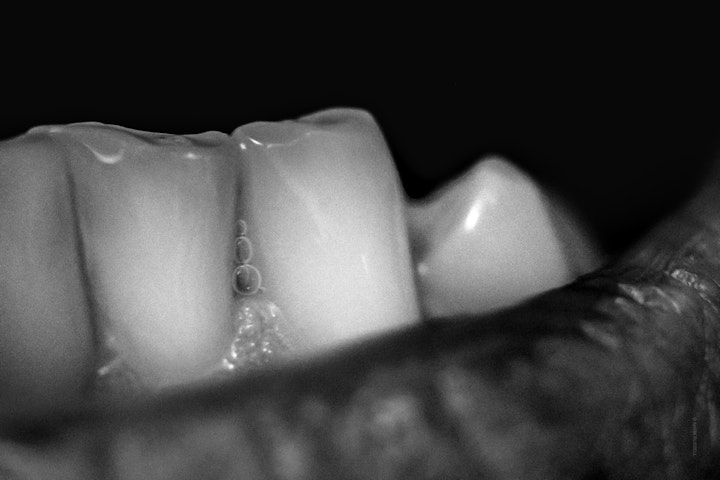 Macro super-closeup of teeth and lips in black and white.