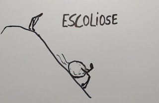 Escoliose