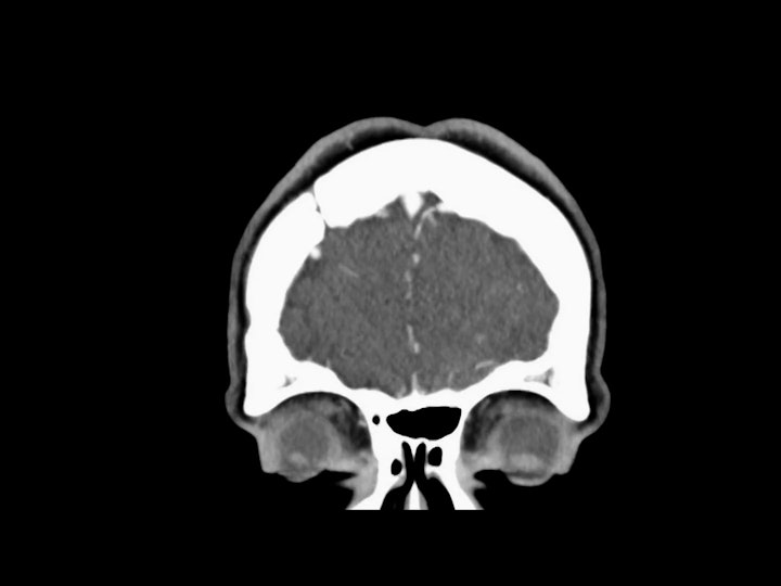Netflix ~ "The Surgeons Cut Sacred Brain"