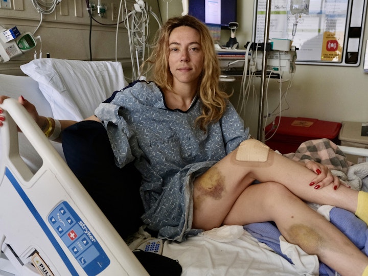 How Los Angeles Police Officers Broke Protocols and Injured Protesters