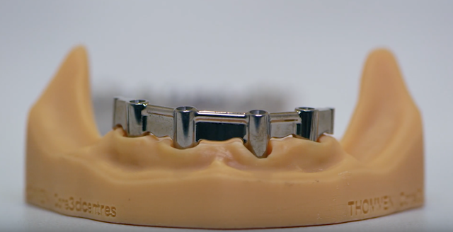 NextDent_10